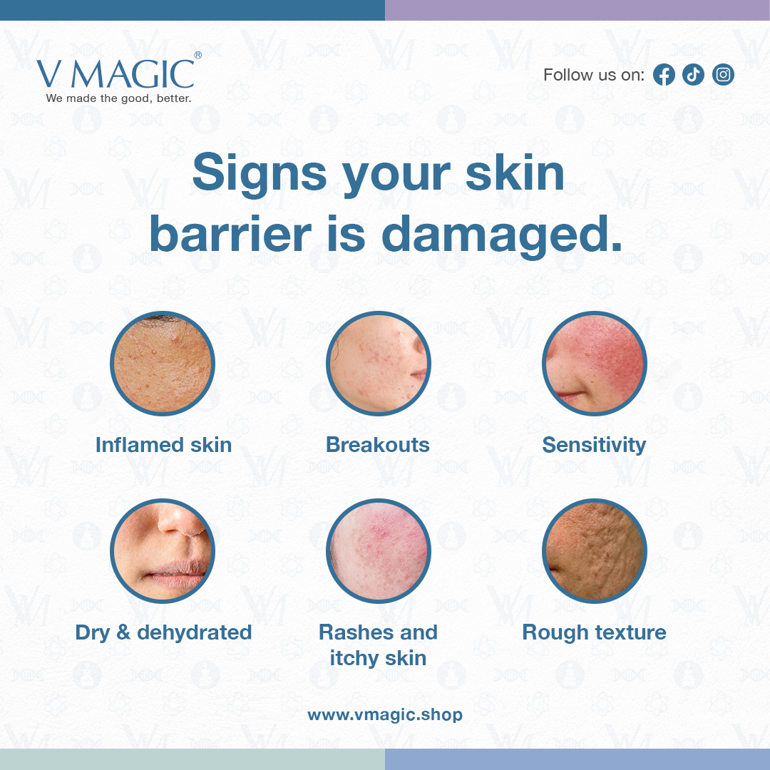 Signs your skin barrier is damaged. Look out for these signs and address them readily. 
